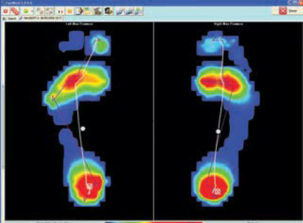 SPI Foottrax 足底压力分布系统（平板式）
