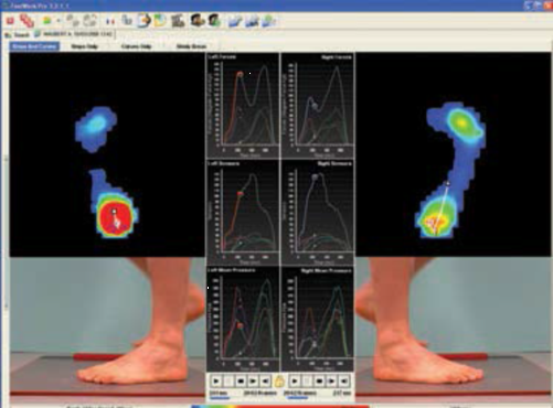 SPI Foottrax 足底压力分布系统（平板式）