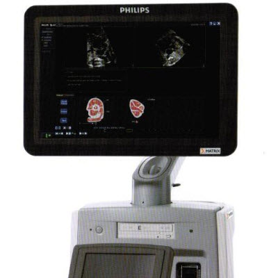飞利浦超声诊断系统IU ELITE
