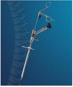 经皮内窥镜引导下胃造口包 CH10