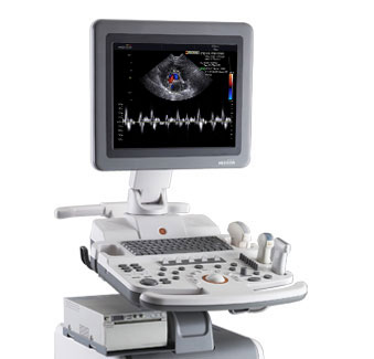 三星麦迪逊Sonovet R5超声