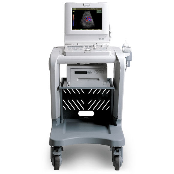 三星麦迪逊SONOACE PICO 全功能便携式数字彩超