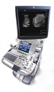 LOGIQ E9 彩色超声诊断系统