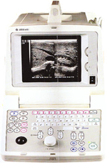 EG LOGIQ 50高档便携式B超