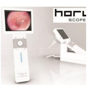 赫罗斯Horus数位耳镜