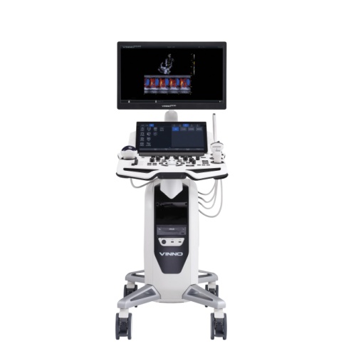 飞依诺数字化彩色超声诊断仪VINNO R530