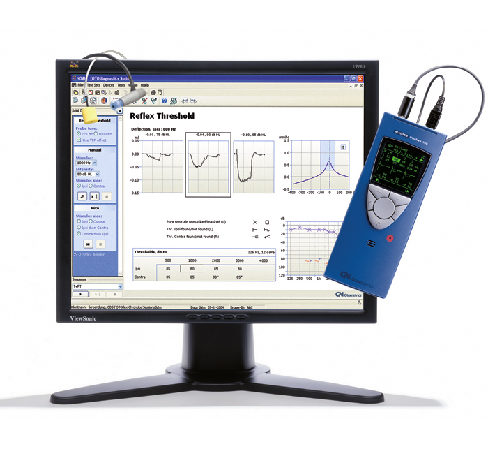 丹麦科研型耳声阻抗测量仪耳听霏 OTOflex 100
