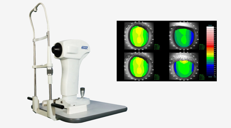 雷蒙光电角膜地形图仪CT-6型 