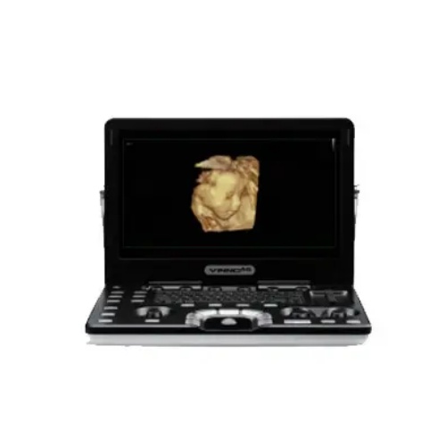 飞依诺便携式数字化彩色超声诊断仪VINNO A5e