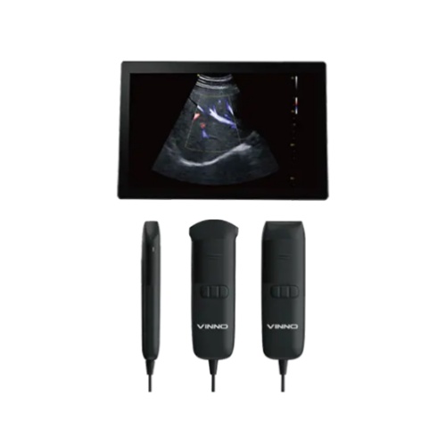 飞依诺掌上彩色超声诊断仪VINNO Q系列 